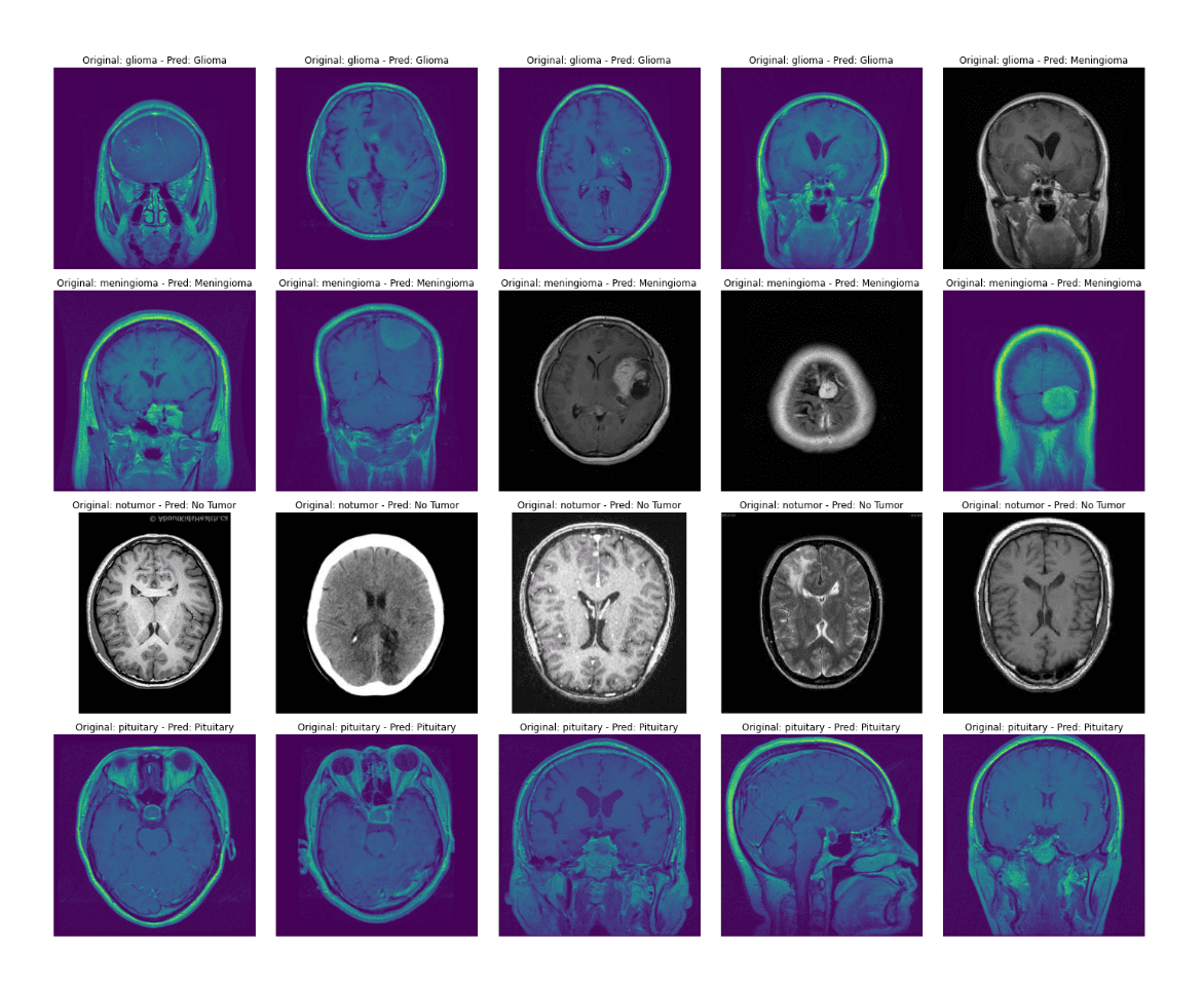 Brain Tumor Classification